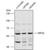 Solarbio K111493P Anti-NRG2 Polyclonal Antibody