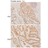 Solarbio K111896P Anti-DLC1 Polyclonal Antibody
