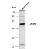 Solarbio K111694P Anti-ADRB2 Polyclonal Antibody