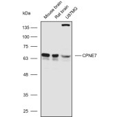 Solarbio K110558P Anti-CPNE7 Polyclonal Antibody