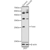Solarbio K009993P Anti-Twist Polyclonal Antibody