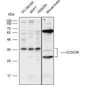 Solarbio K111796P Anti-CCDC59 Polyclonal Antibody