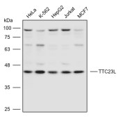 Solarbio K111001P Anti-TTC23L Polyclonal Antibody