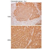 Solarbio K111726P Anti-CD74 Polyclonal Antibody