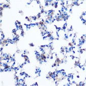 Solarbio K009920P Anti-PKM2 Polyclonal Antibody