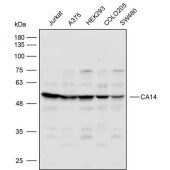 Solarbio K111735P Anti-CA14 Polyclonal Antibody