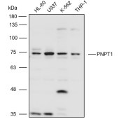 Solarbio K111085P Anti-PNPT1 Polyclonal Antibody