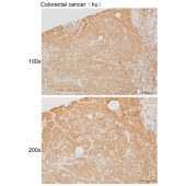 Solarbio K111895P Anti-ABL1 Polyclonal Antibody