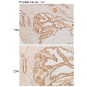 Solarbio K111884P Anti-ATP2A1 Polyclonal Antibody