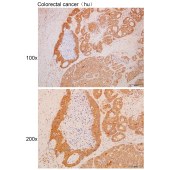 Solarbio K111694P Anti-ADRB2 Polyclonal Antibody