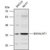 Solarbio K111013P Anti-B3GALNT1 Polyclonal Antibody