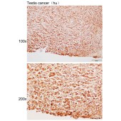 Solarbio K111717P Anti-PAGE2 Polyclonal Antibody