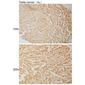 Solarbio K111945P Anti-PPP1R18 Polyclonal Antibody