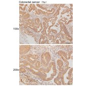 Solarbio K111230P Anti-ST3GAL3 Polyclonal Antibody