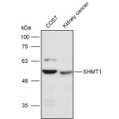 Solarbio K110981P Anti-SHMT1 Polyclonal Antibody