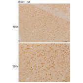 Solarbio K111884P Anti-ATP2A1 Polyclonal Antibody
