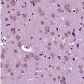 Solarbio K009946P Anti-DCX/Doublecortin?Polyclonal Antibody