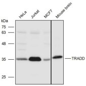 Solarbio K111477P Anti-TRADD Polyclonal Antibody