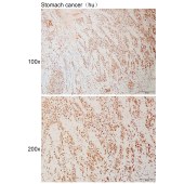 Solarbio K111007P Anti-UTP6 Polyclonal Antibody