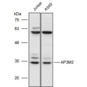 Solarbio K111460P Anti-AP3M2 Polyclonal Antibody