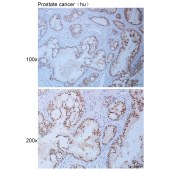 Solarbio K111114P Anti-GCFC2 Polyclonal Antibody