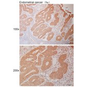 Solarbio K110996P Anti-VPS4A Polyclonal Antibody