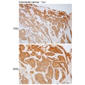 Solarbio K111802P Anti-PSME4 Polyclonal Antibody
