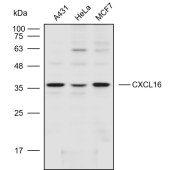 Solarbio K110616P Anti-CXCL16 Polyclonal Antibody