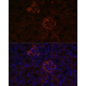 Solarbio K009991P Anti-NPHS1 Polyclonal Antibody