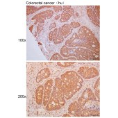 Solarbio K111727P Anti-NUDT1 Polyclonal Antibody