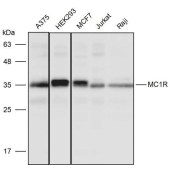 Solarbio K111478P Anti-MC1R Polyclonal Antibody