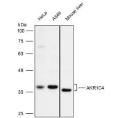 Solarbio K111938P Anti-AKR1C4 Polyclonal Antibody