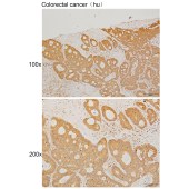 Solarbio K111447P Anti-AKAP9 Polyclonal Antibody