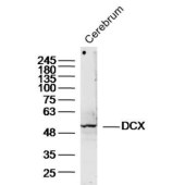 Solarbio K009946P Anti-DCX/Doublecortin?Polyclonal Antibody