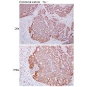 Solarbio K111432P Anti-STEAP3 Polyclonal Antibody