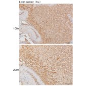 Solarbio K111407P Anti-KCNN3 Polyclonal Antibody