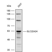 Solarbio K111901P Anti-SLC22A24 Polyclonal Antibody