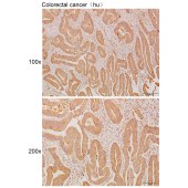 Solarbio K110965P Anti-PEX5L Polyclonal Antibody