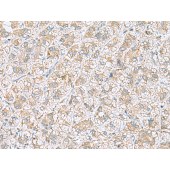Solarbio K009879P Anti-NDRG4 Polyclonal Antibody