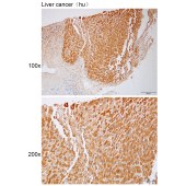 Solarbio K112210P Anti-CLASP1 Polyclonal Antibody