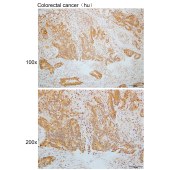 Solarbio K110115P Anti-KEAP1 Polyclonal Antibody