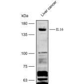 Solarbio K112415P Anti-IL16 Polyclonal Antibody