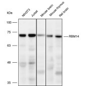 Solarbio K109946P Anti-RBM14 Polyclonal Antibody