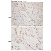 Solarbio K110082P Anti-RSRC2 Polyclonal Antibody
