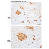 Solarbio K110135P Anti-KCNK9 Polyclonal Antibody