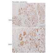 Solarbio K110364P Anti-OGDH Polyclonal Antibody