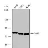 Solarbio K009799P Anti-GAB2 Polyclonal Antibody