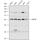 Solarbio K110385P Anti-DBF4B Polyclonal Antibody