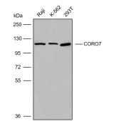 Solarbio K009832P Anti-CORO7 Polyclonal Antibody