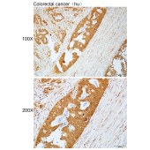 Solarbio K112282P Anti-RBPMS Polyclonal Antibody